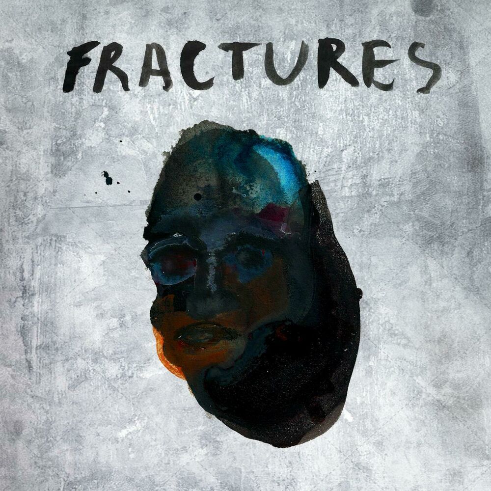 Picture of Fractures