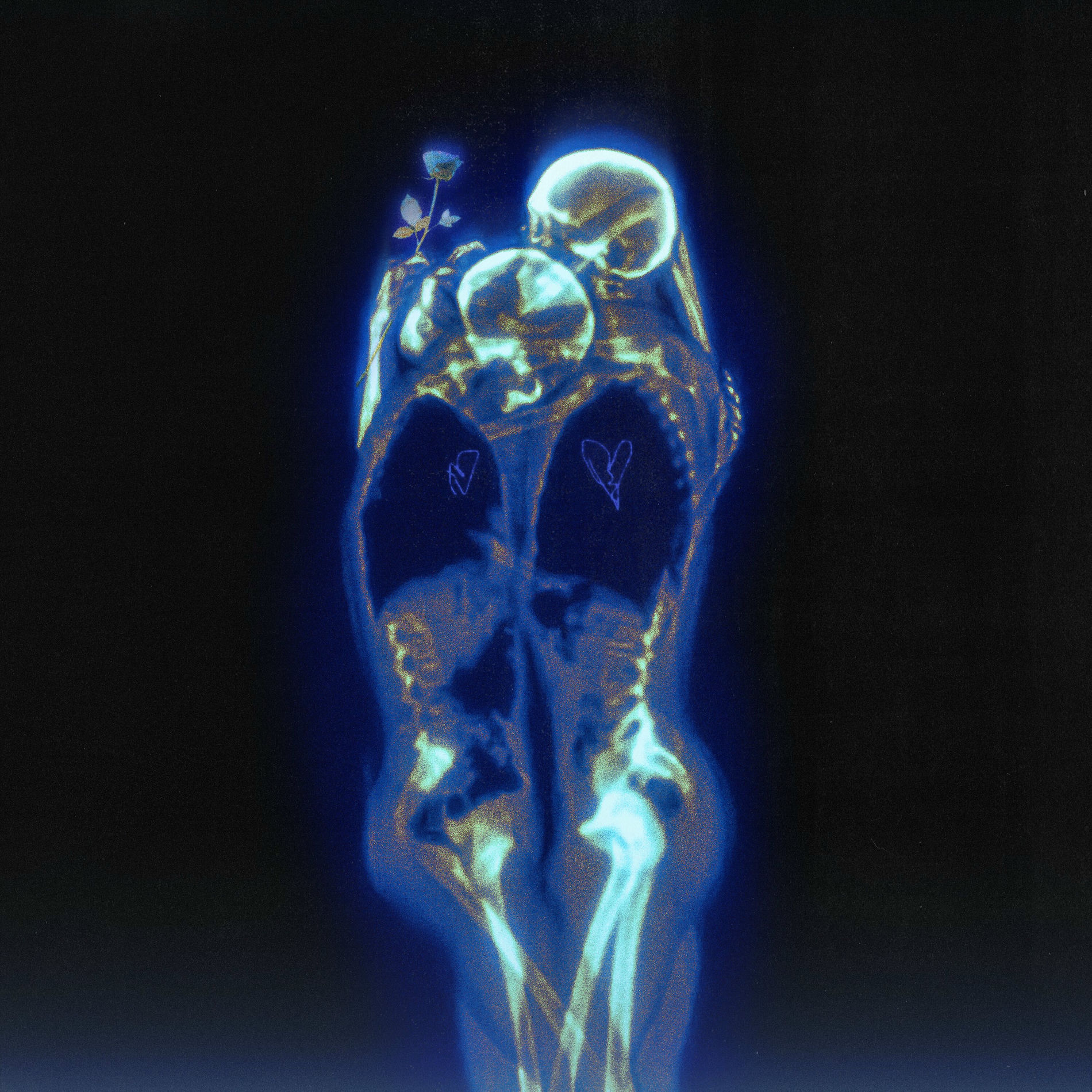 Album cover of CHIARA