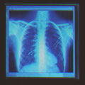 Bones