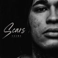 Scars