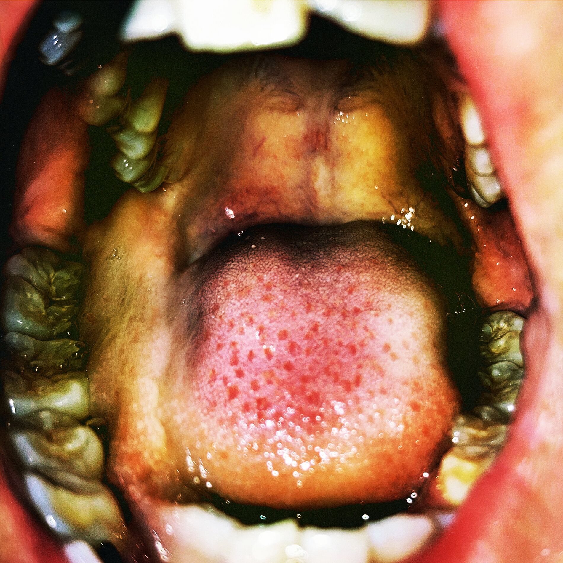 Album cover of Gutter