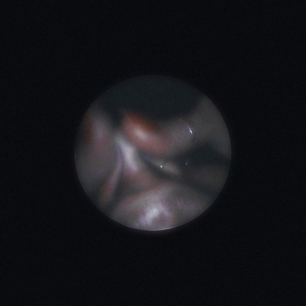 Satellite cover