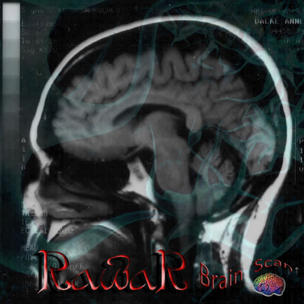 Picture of Brain Scan