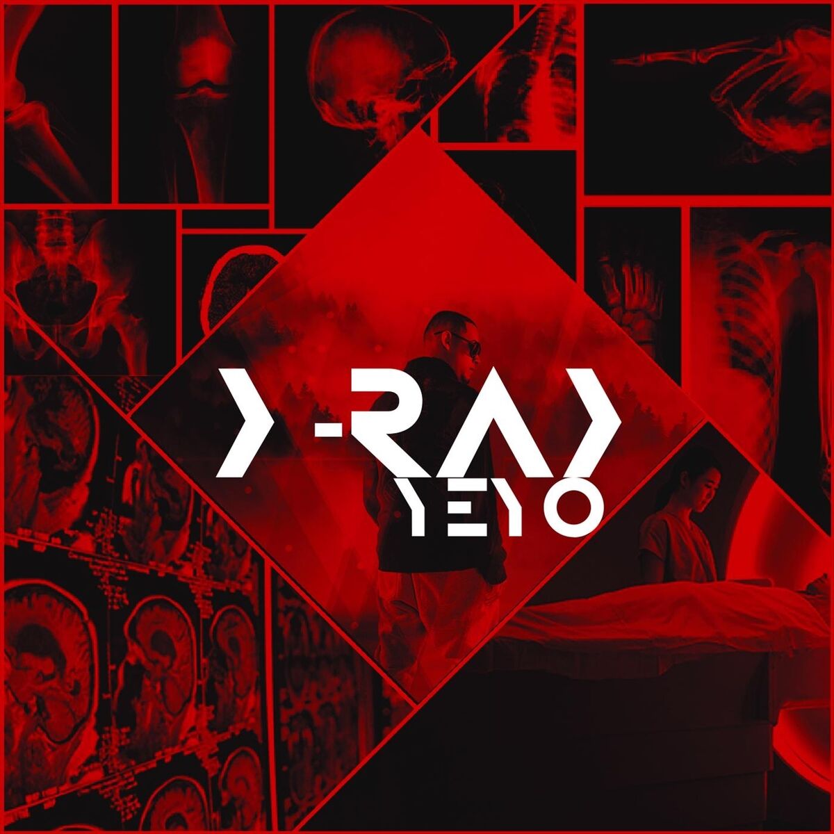 Album cover of X-Ray