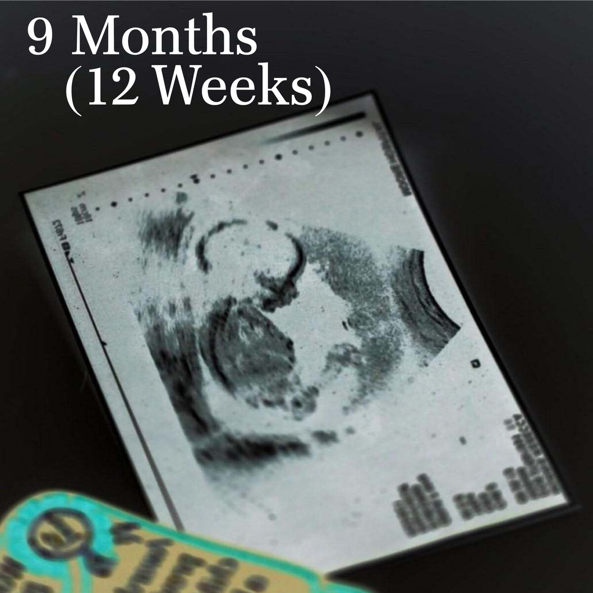 Album cover of 9 Months (12 Weeks)
