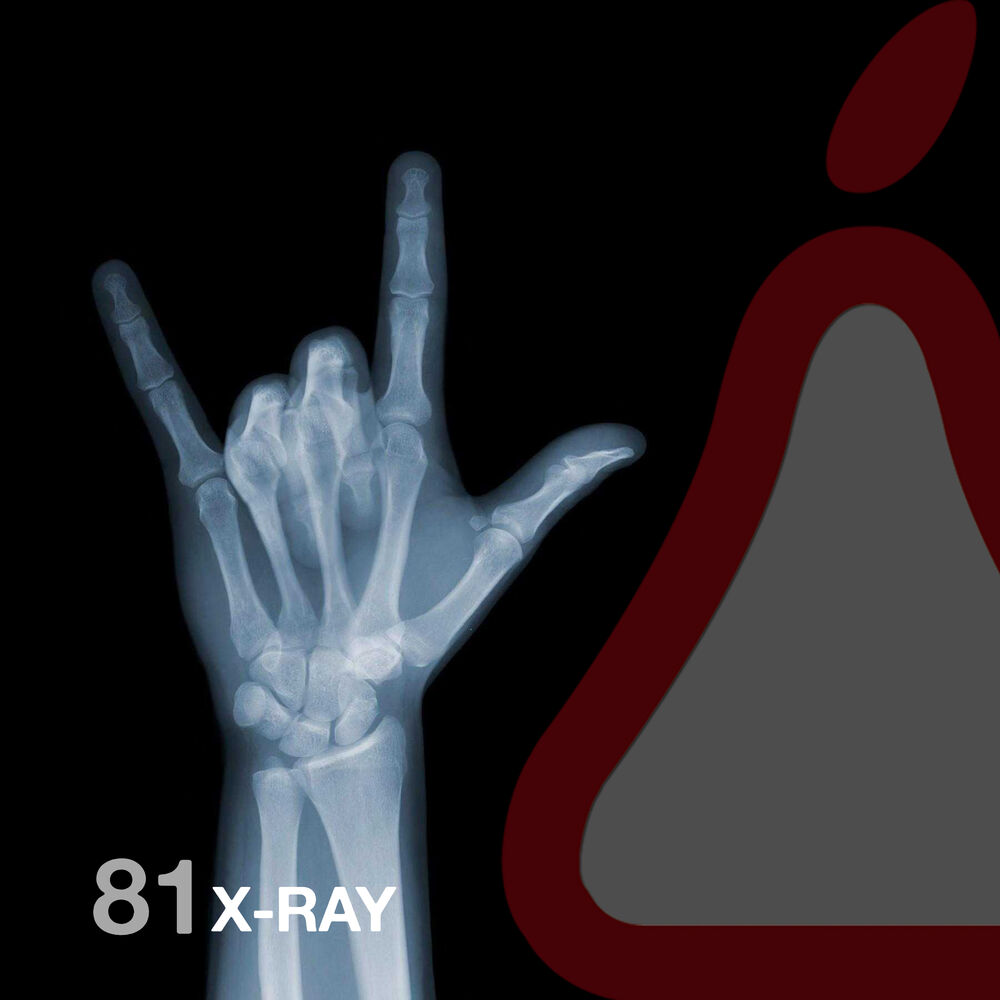 Picture of X-Ray