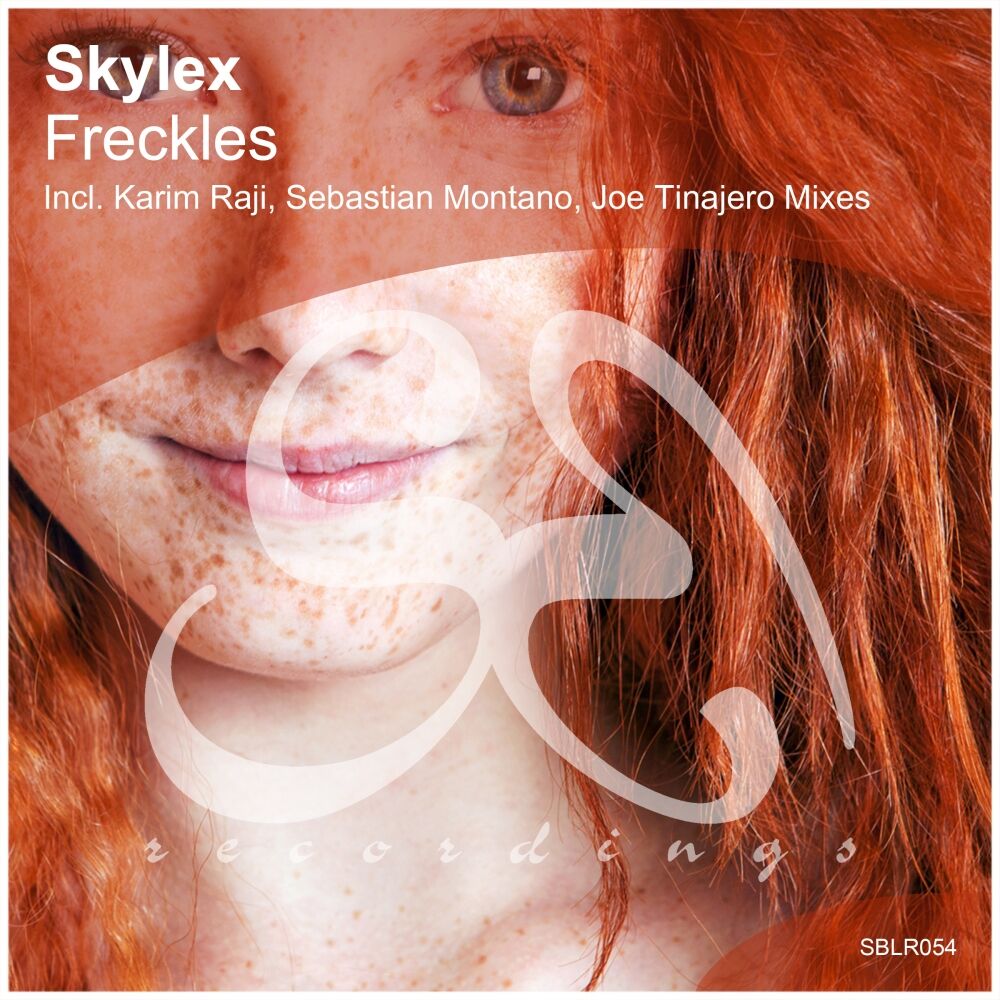 Picture of Freckles