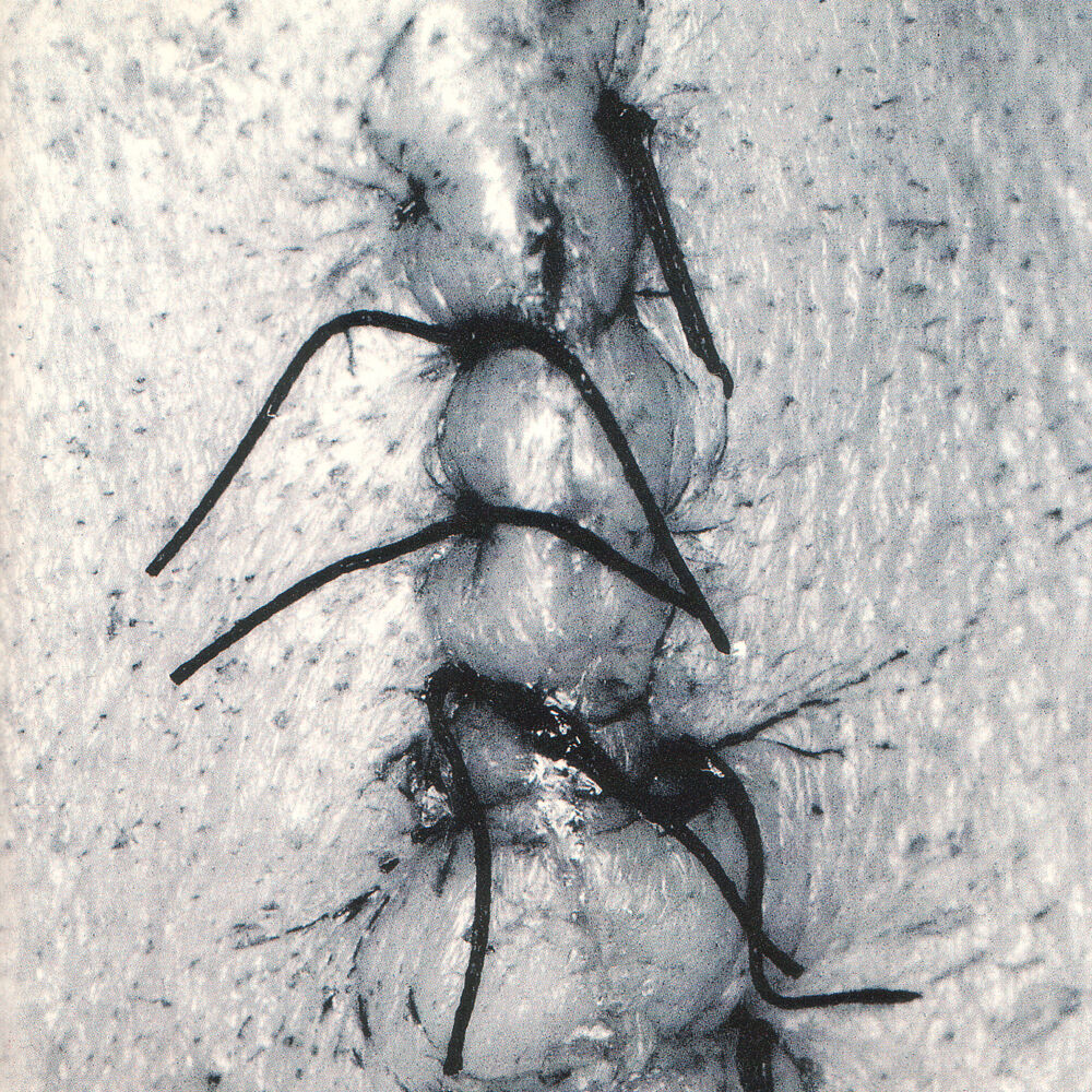 Picture of Infliction