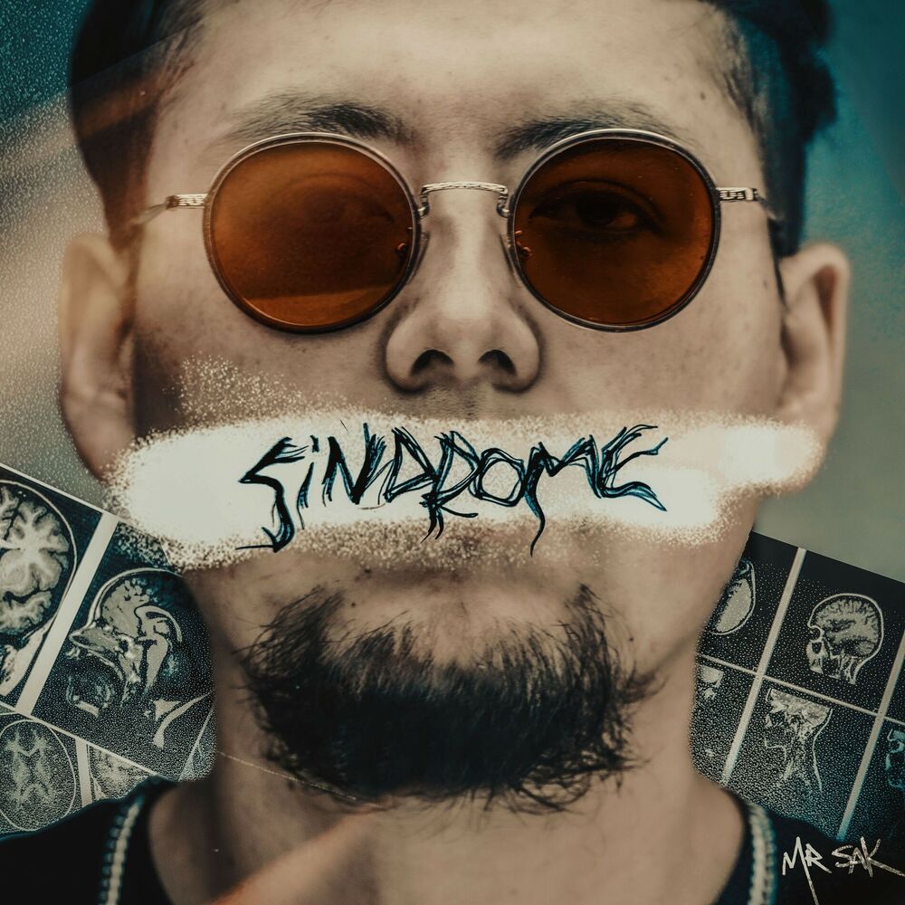 Picture of Síndrome