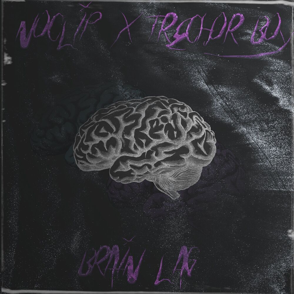 Picture of brain lag