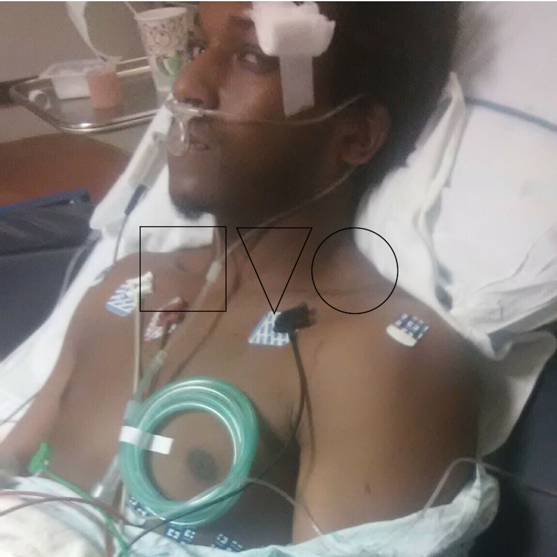 Album cover of Seizure Moment