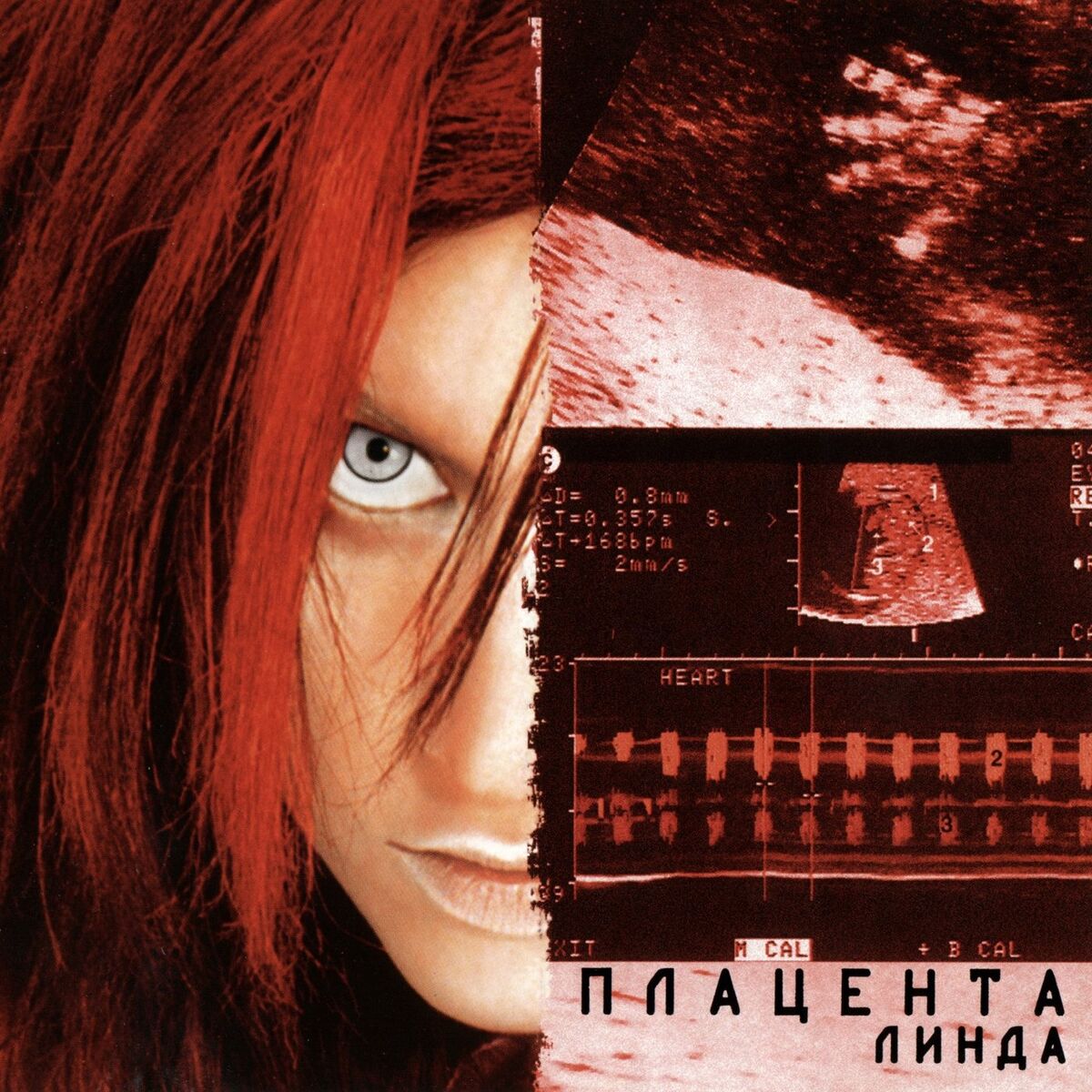 Album cover of Плацента