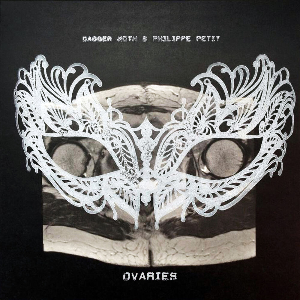 Picture of Ovaries