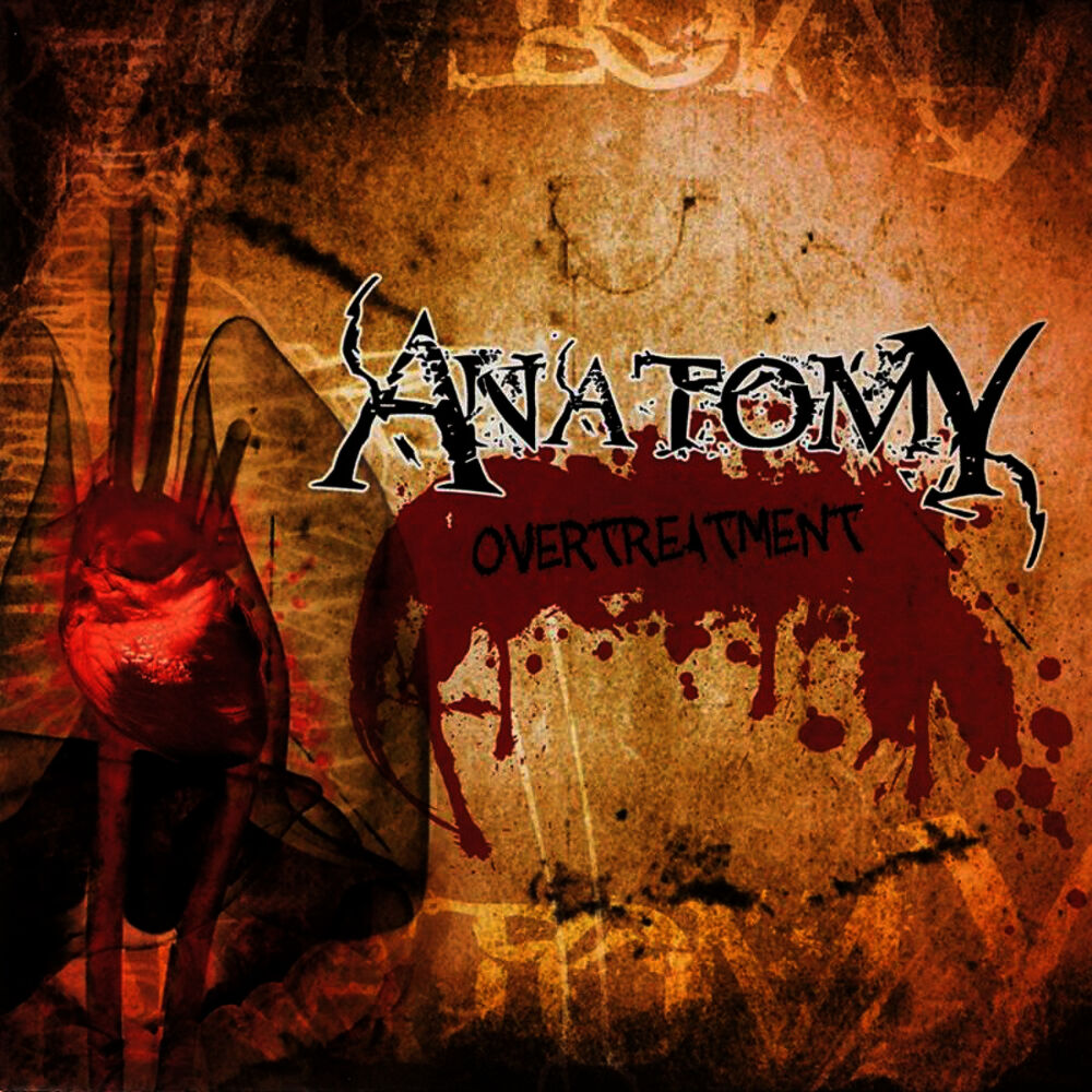 Picture of Overtreatment