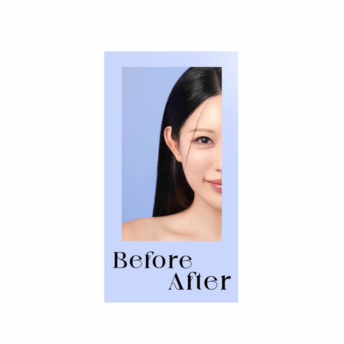 kkonya – Before After – Single