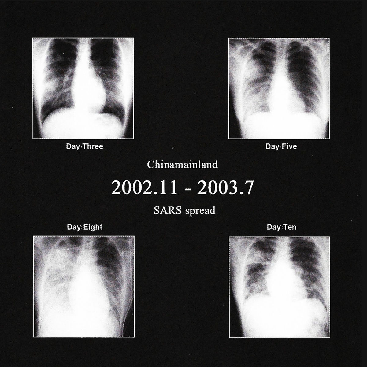 Album cover of 348 ?! SARS spread...