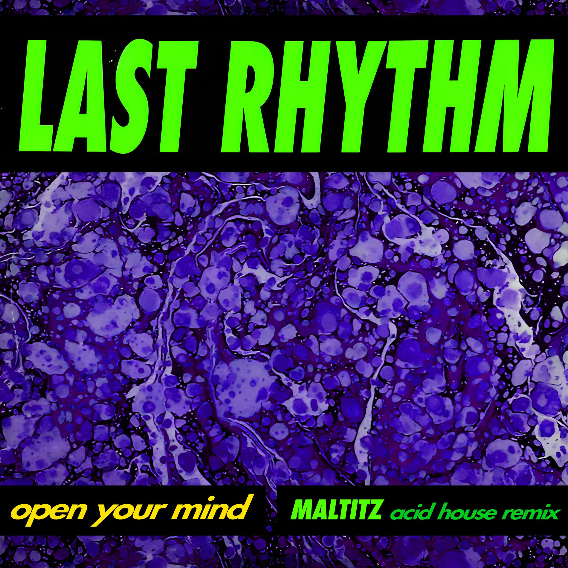 Album cover of Open Your Mind (Maltitz Acid House Remix)