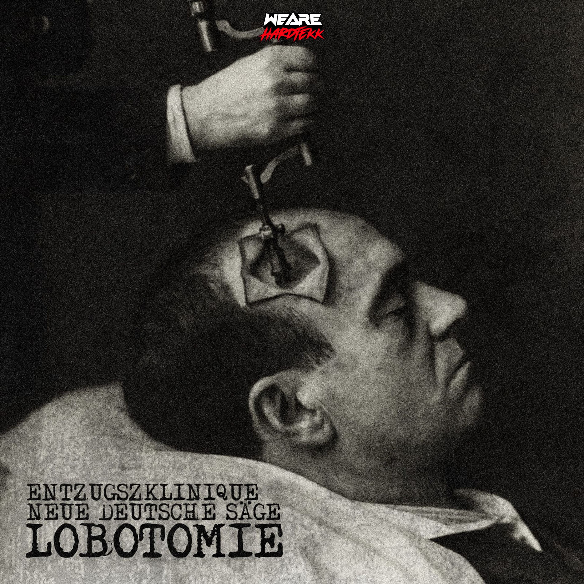 Album cover of Lobotomie