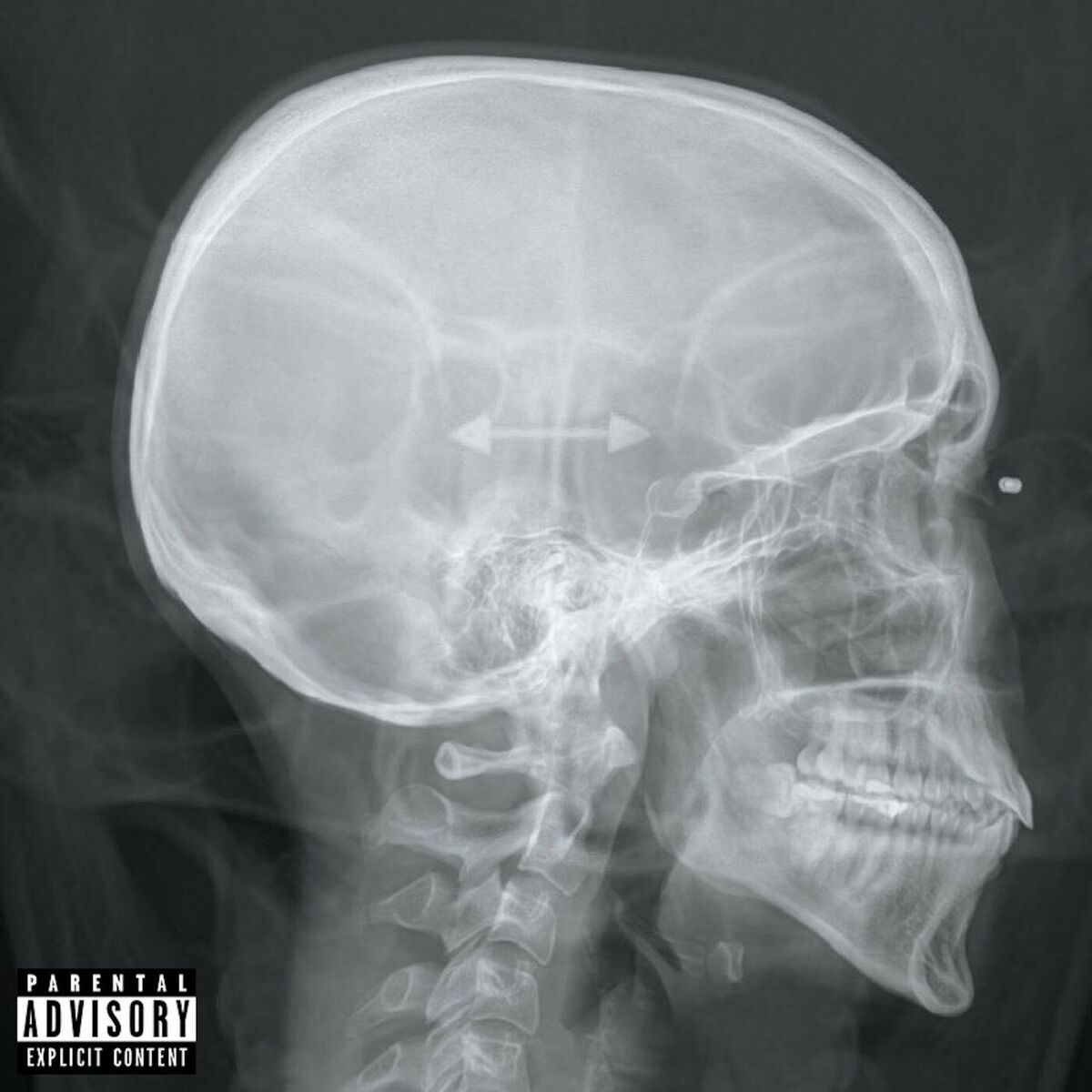 Album cover of Psychopath