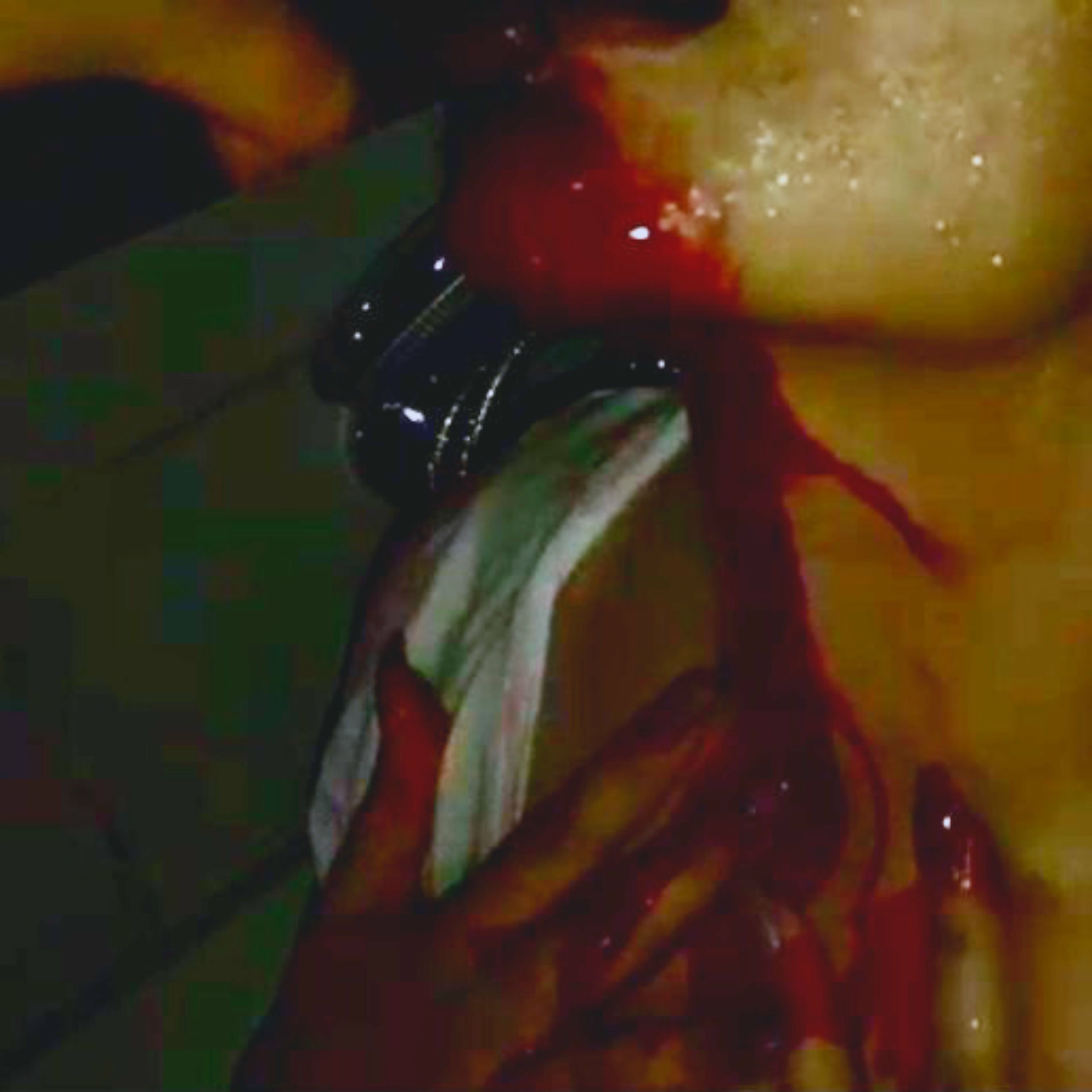 Album cover of Blutbad