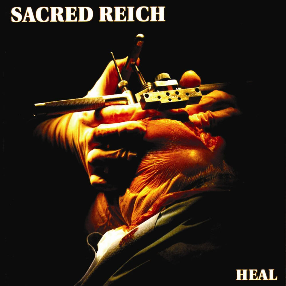 Picture of Heal