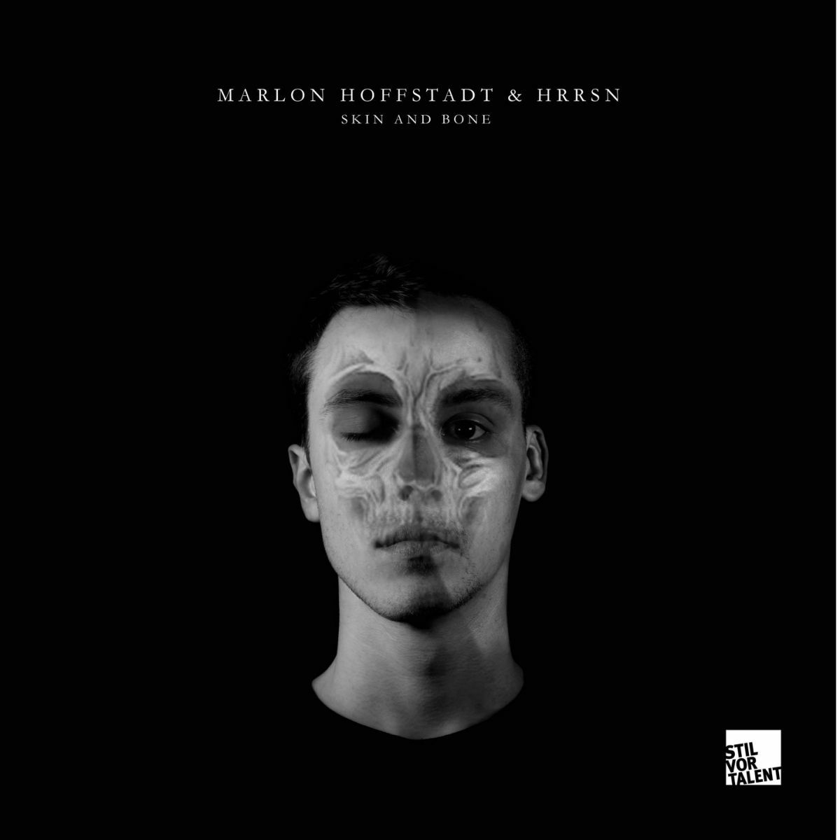 Album cover of Skin and Bone