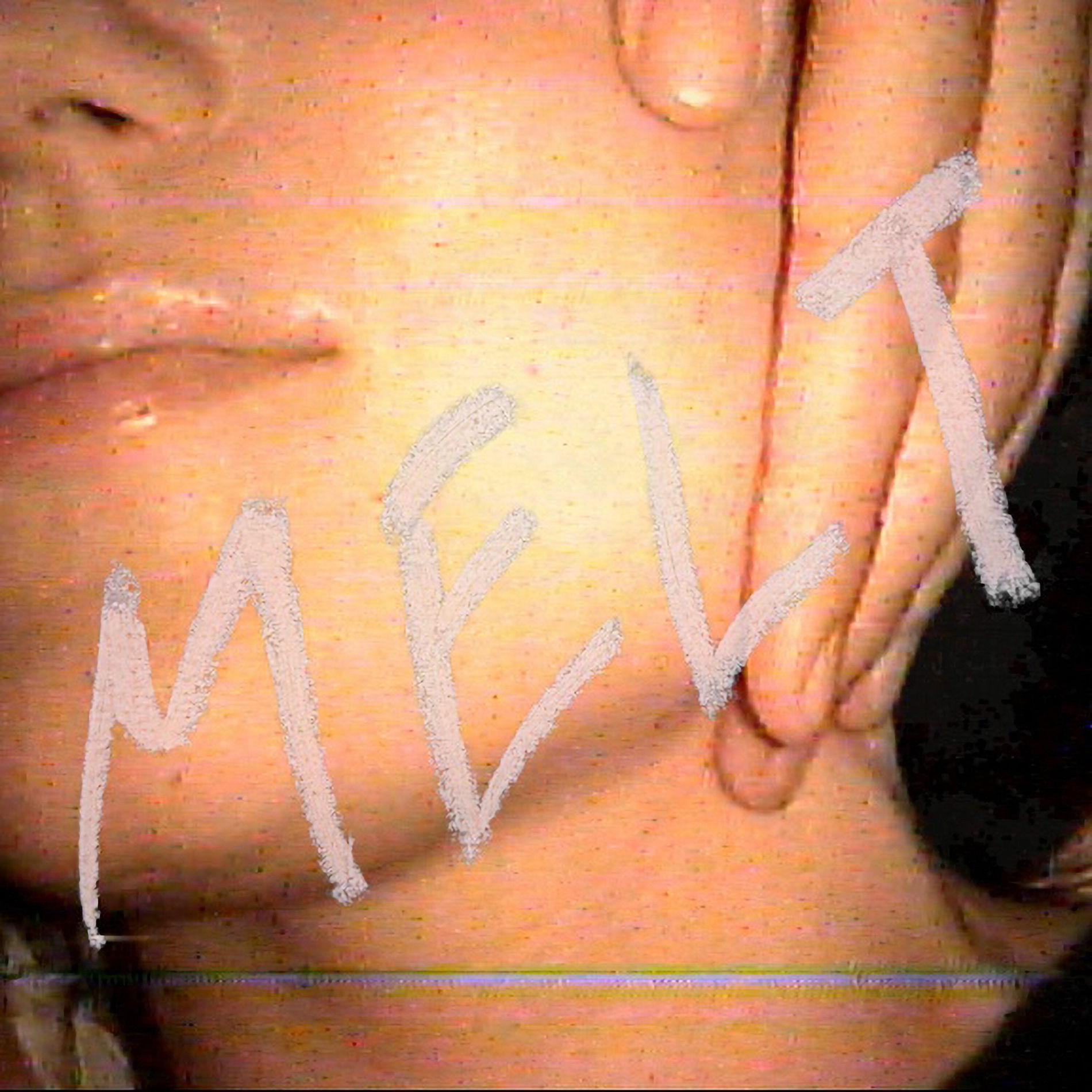 Album cover of MELT
