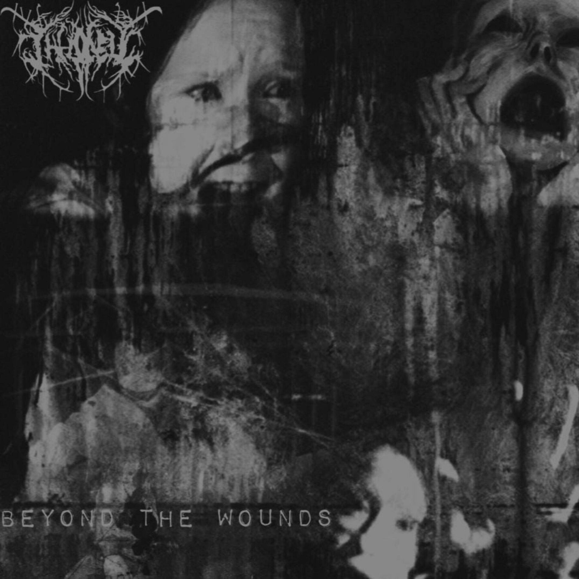 Album cover of Beyond The Wounds