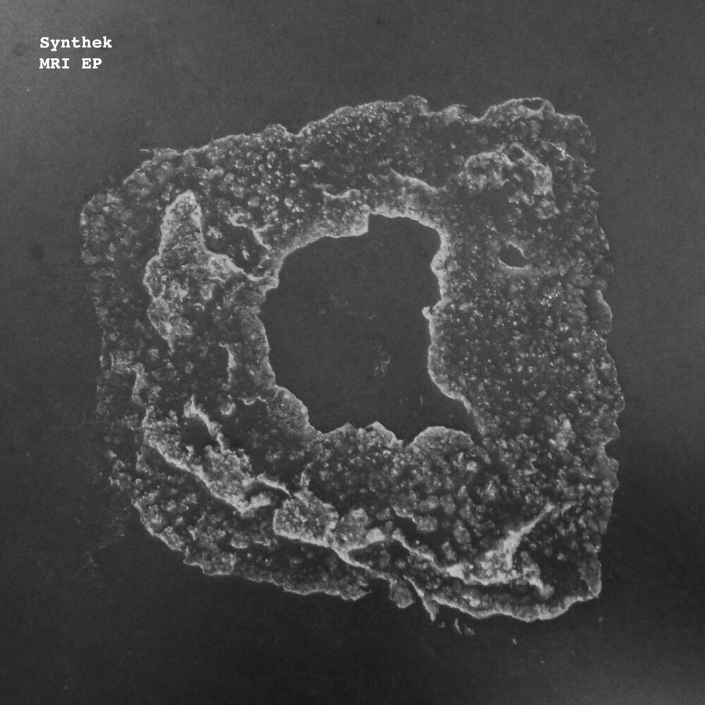 Picture of MRI EP