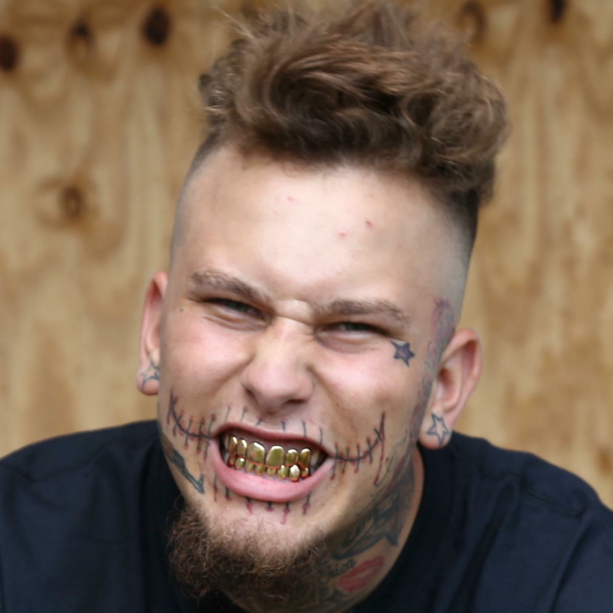 Stitches: album, låtar, konserter | Deezer