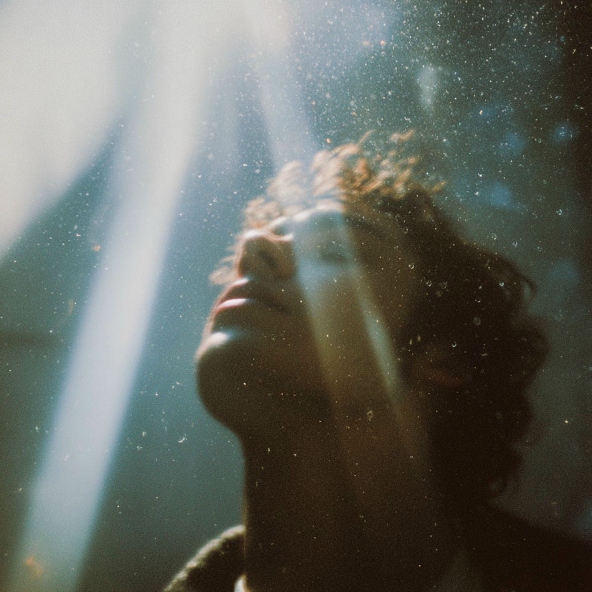 Album cover of Hurts too Much (Abakus' Acoustic Dreamscape Version)