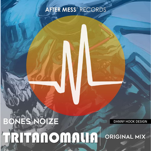 Tritanomalía