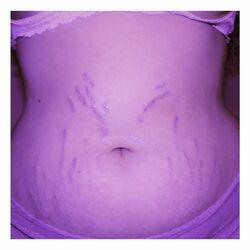 Cover of Diet Culture (Stripped)