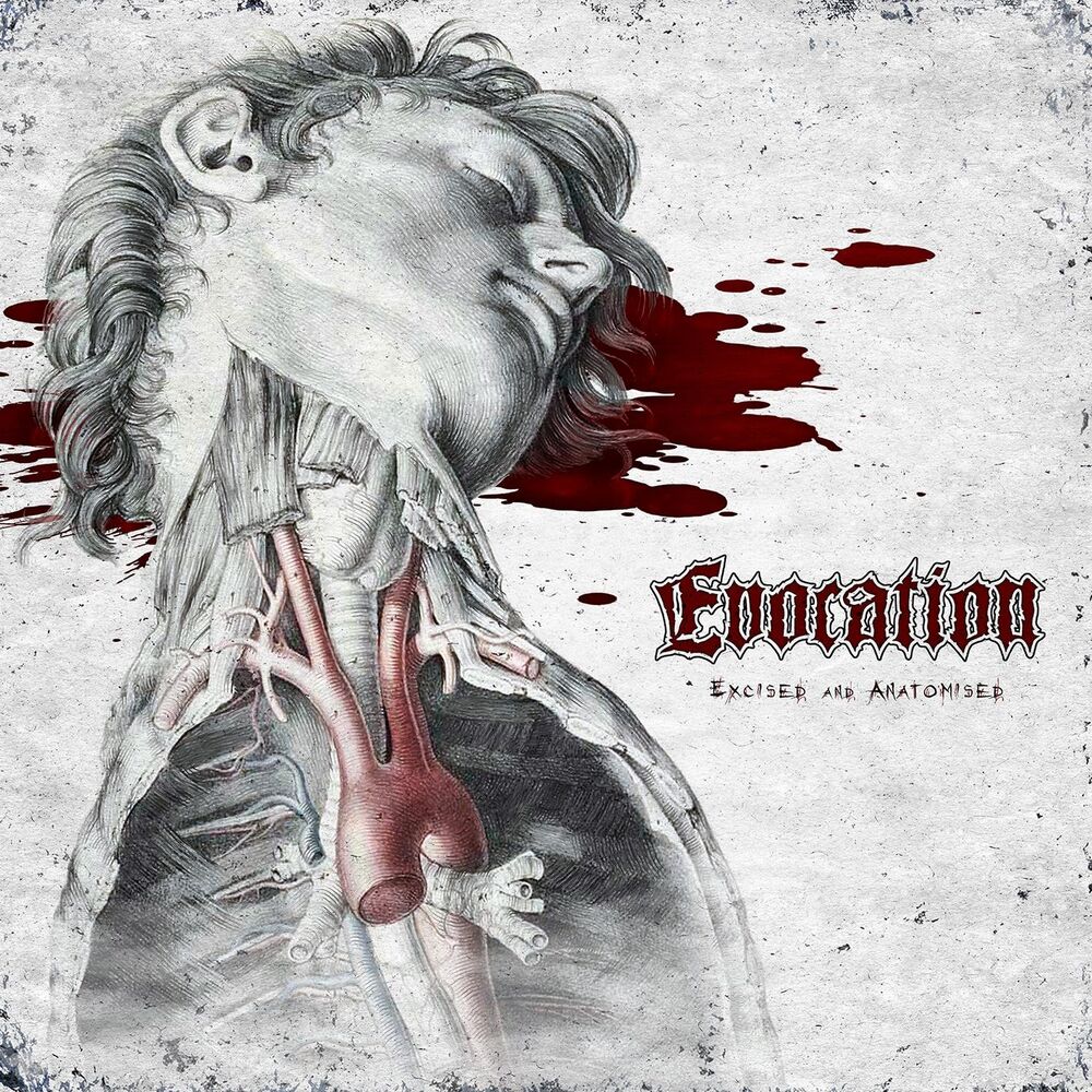 Picture of Excised and Anatomised