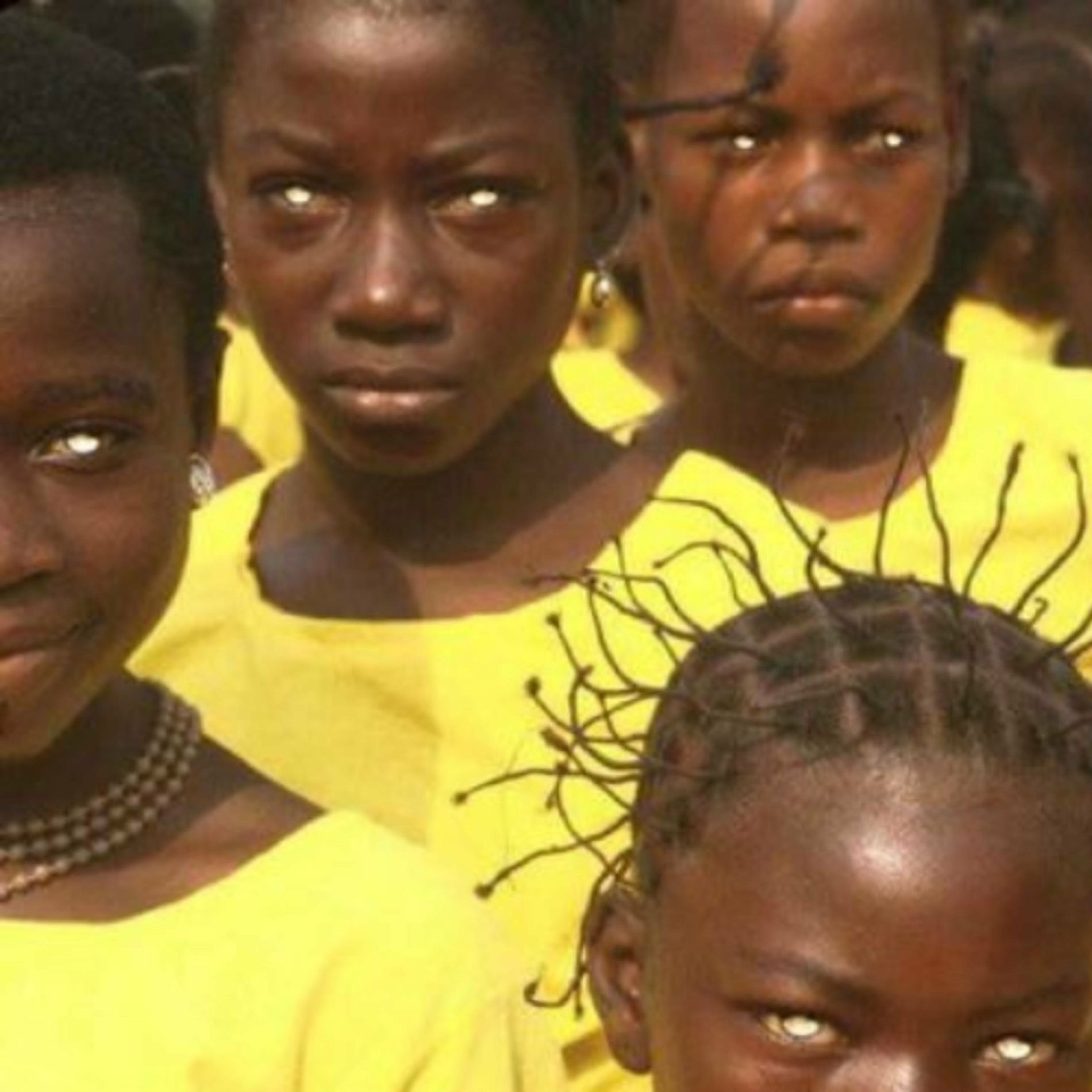 Album cover of Tired Eyes (feat. Blon & Ziggy Stri)