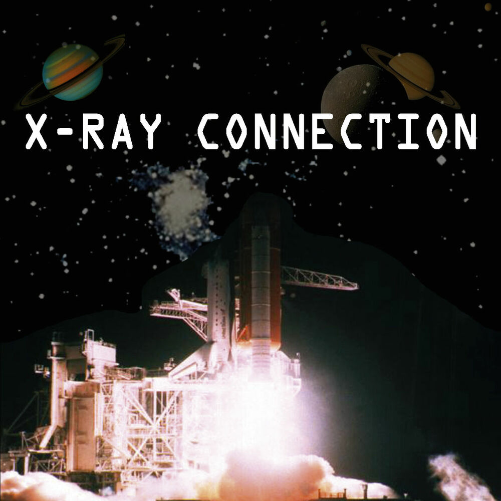 Picture of X-Ray Connection