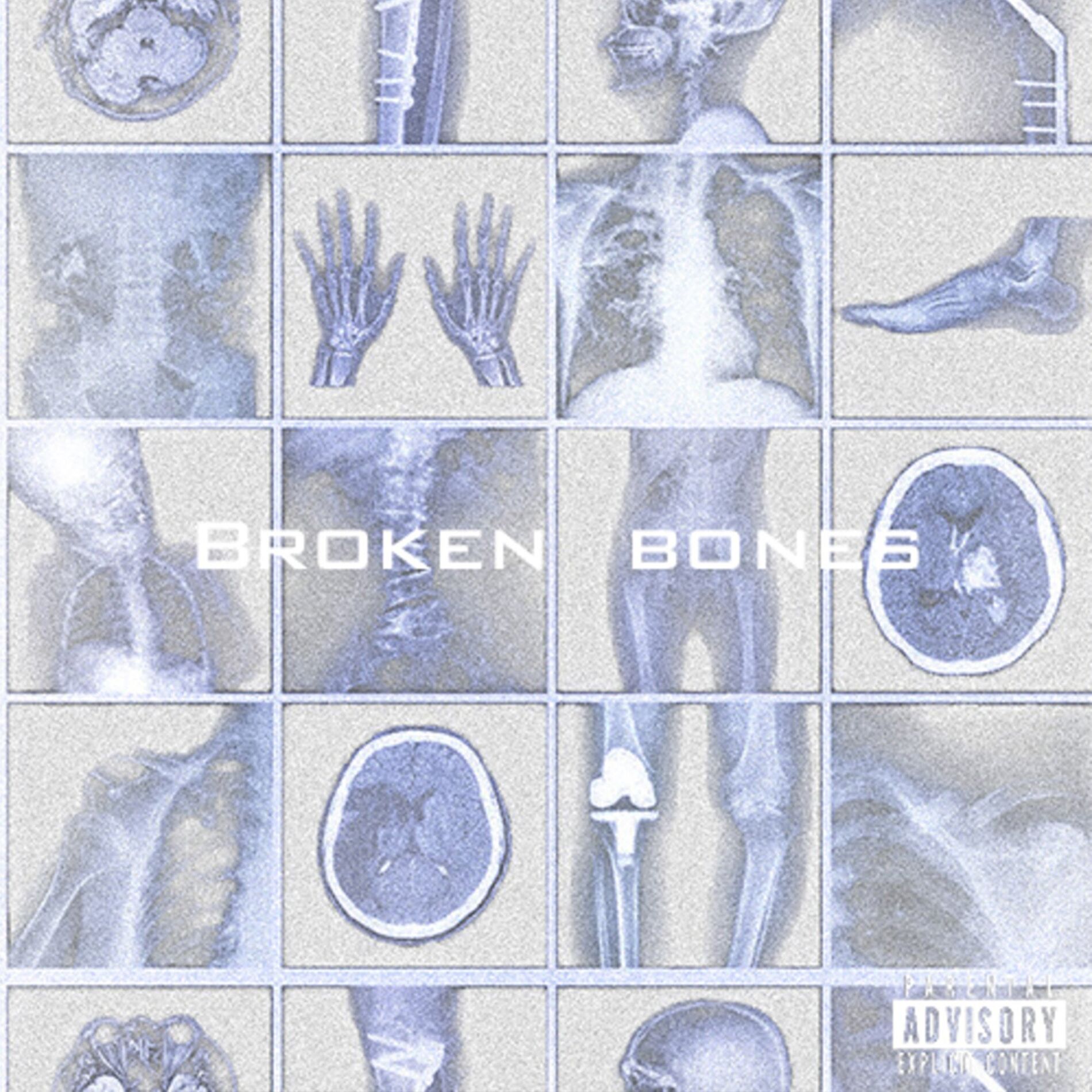Album cover of Broken Bones