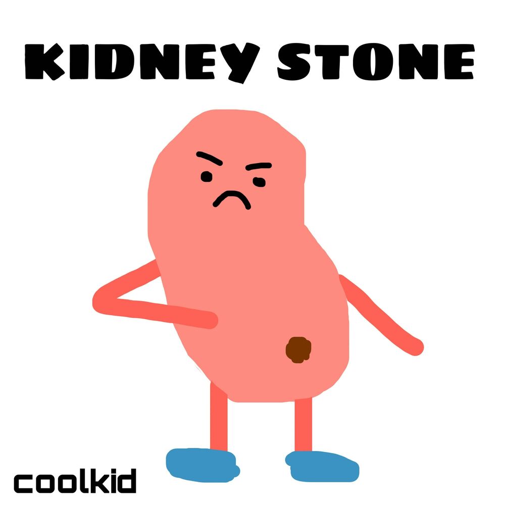Picture of KIDNEY STONE