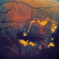 Light Leaks