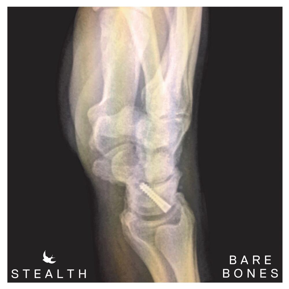 Picture of Bare Bones