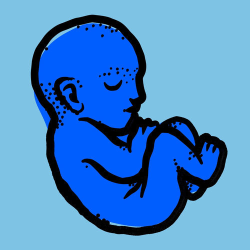 Born artwork