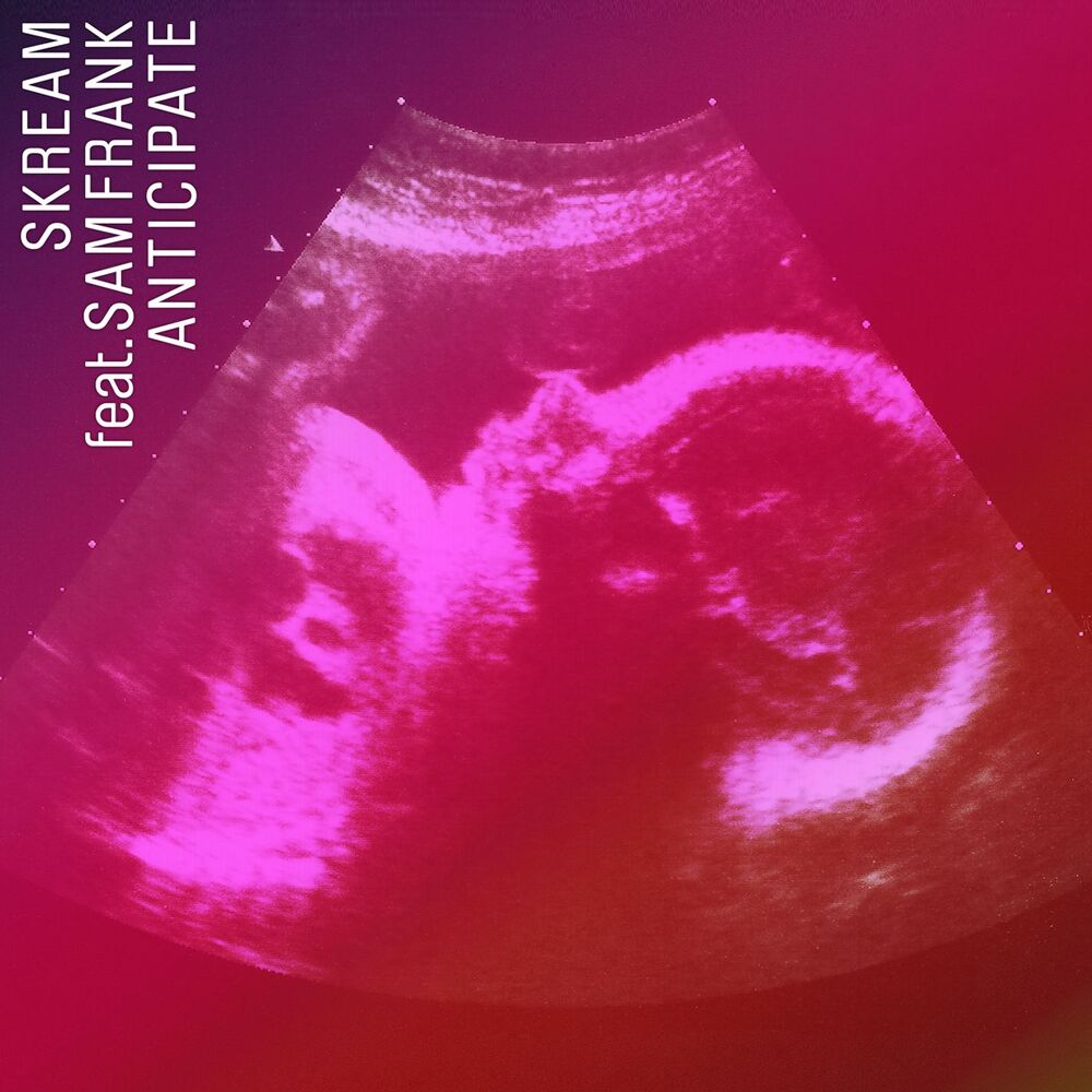Picture of Anticipate EP