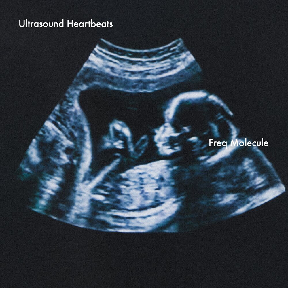 Picture of Ultrasound Heartbeats