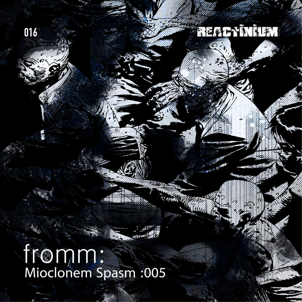 Picture of Mioclonem Spasm: 005
