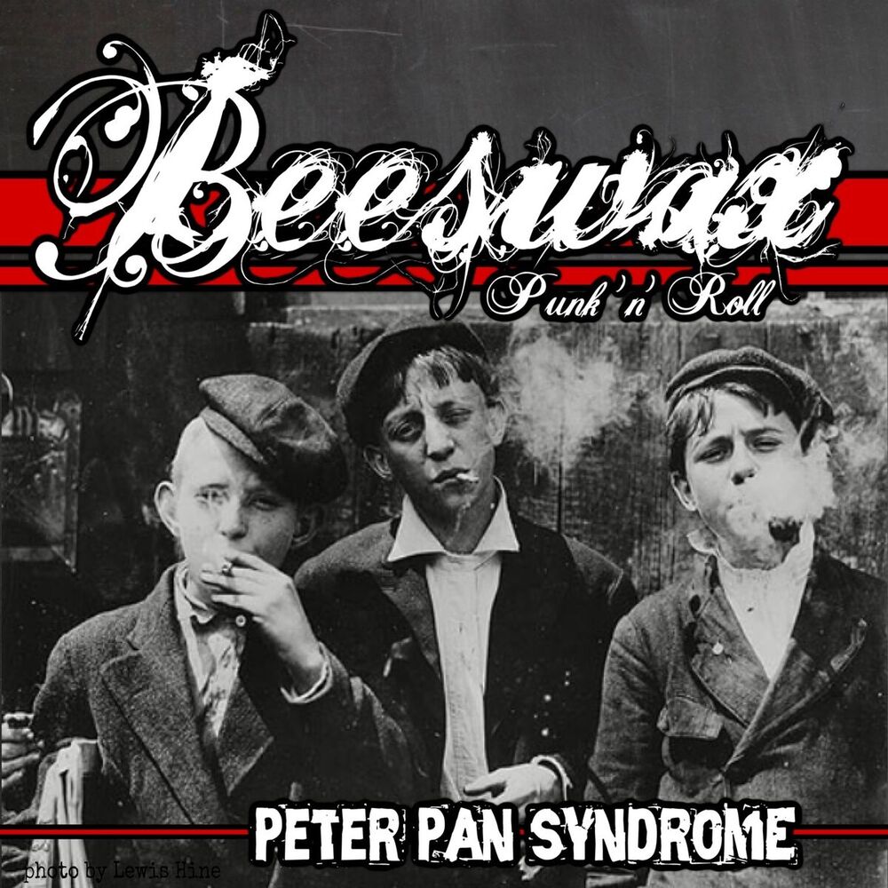 Picture of Peter Pan Syndrome