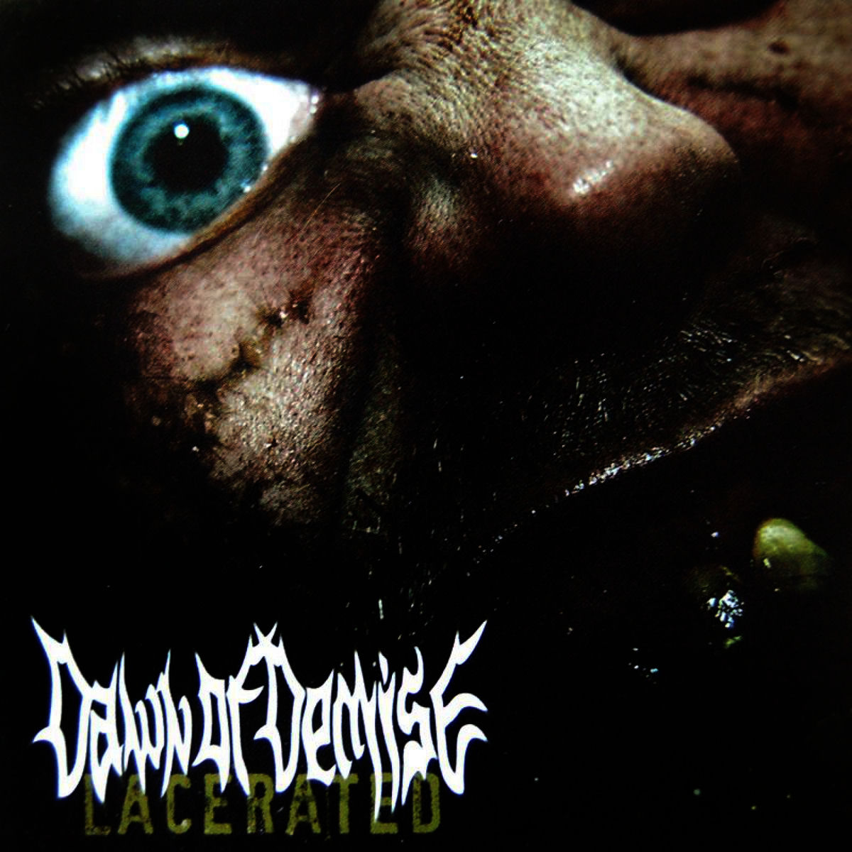 Dawn of Demise - Lacerated | Deezer