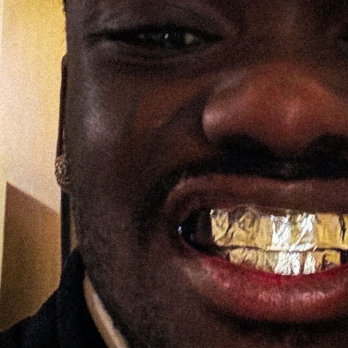 Album cover of WIN WIN