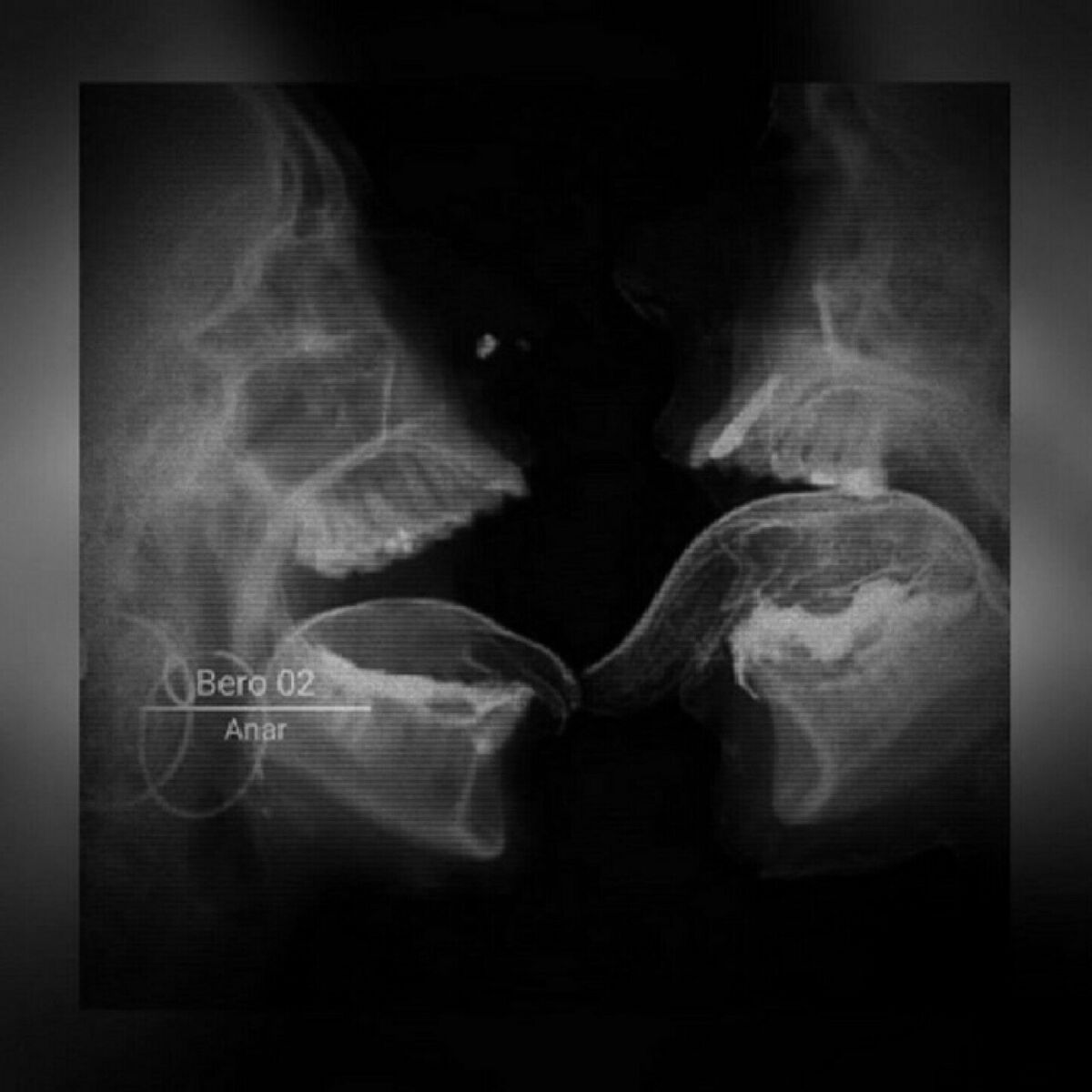 Album cover of BERO 02 - Ultra Slowed