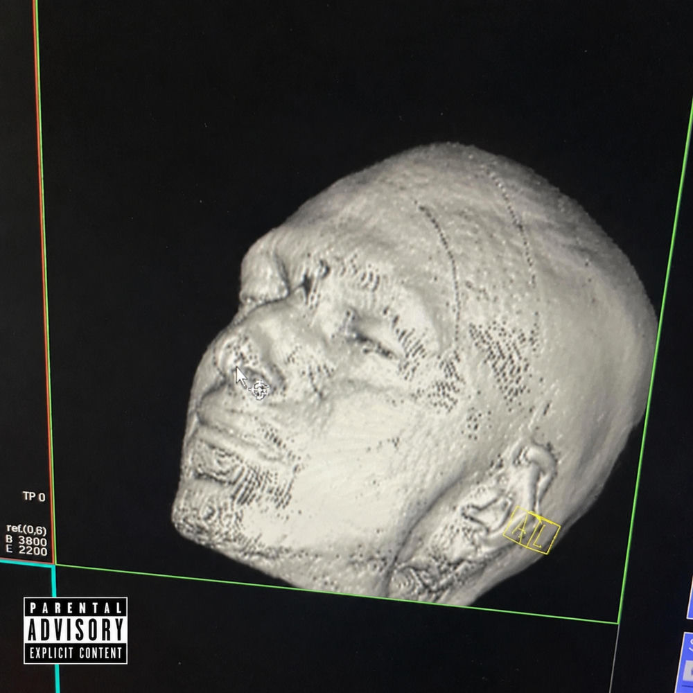 Delay artwork