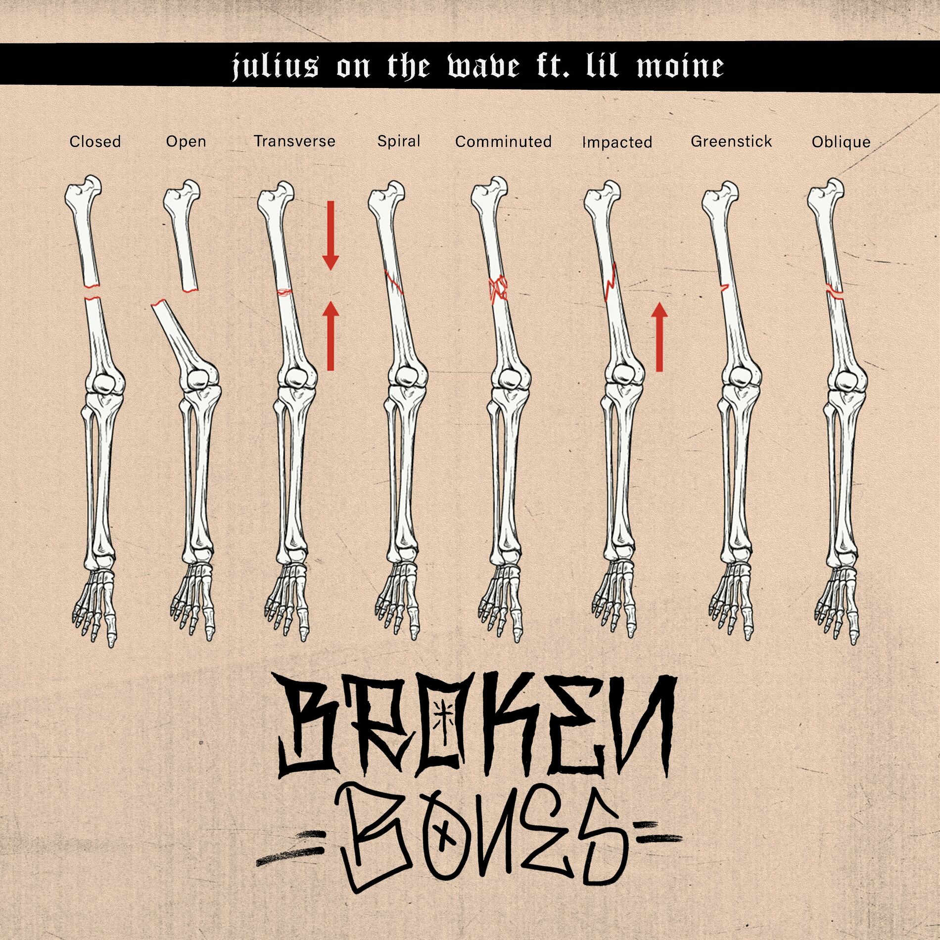 Album cover of BROKEN BONES